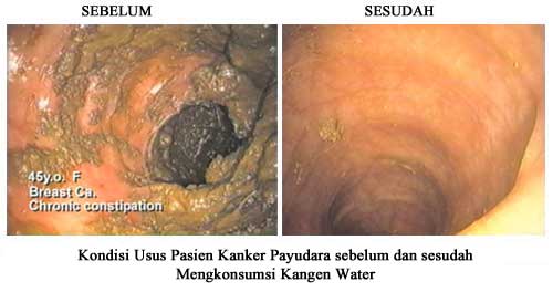 Kangen Water Balikpapan - Sahabatnesia